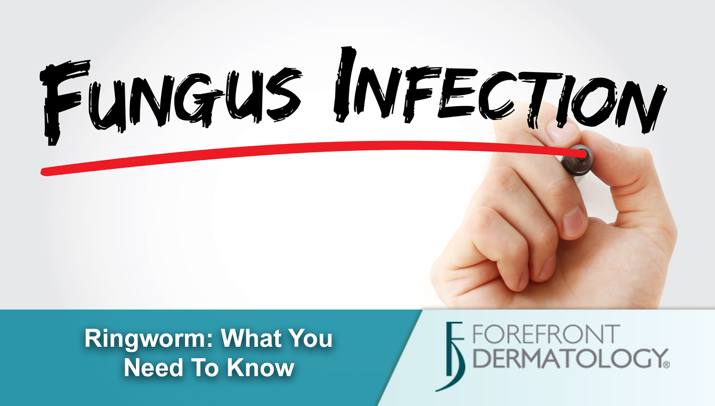 Ringworm: What You Need to Know