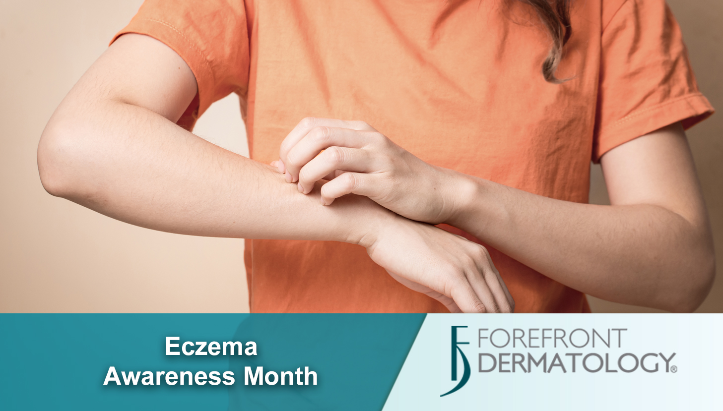 Eczema 101