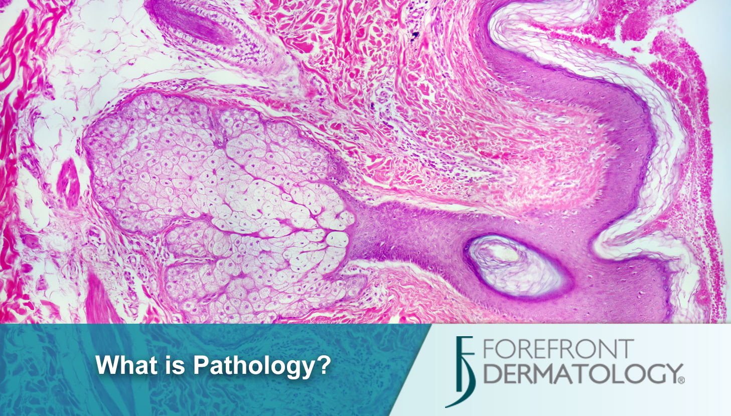 I was charged for Pathology services – what is that?