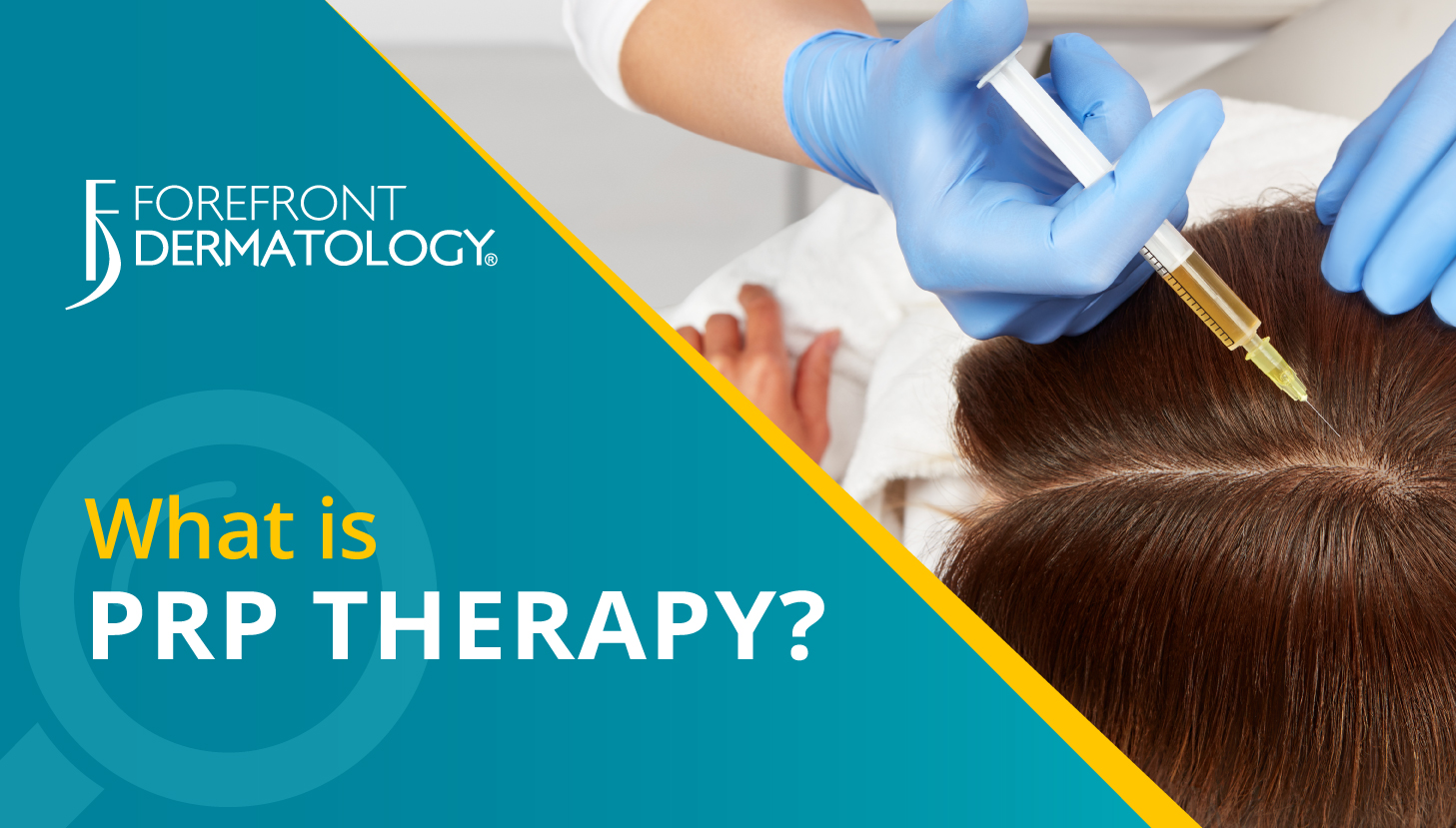 What is Platelet-Rich Plasma (PRP) Therapy?