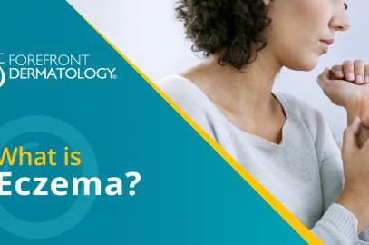 Eczema: What You Need To Know