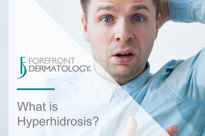 Managing Hyperhidrosis