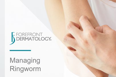 Managing Ringworm