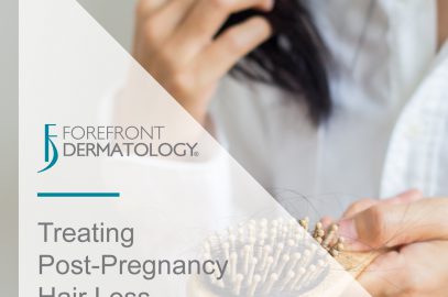 Treating Postpartum Hair Loss