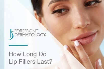 How Long Do Lip Fillers Last?