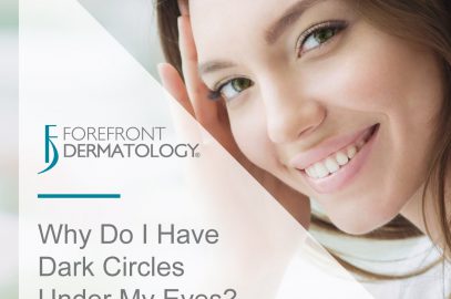 Why Do I Have Dark Circles Under My Eyes?