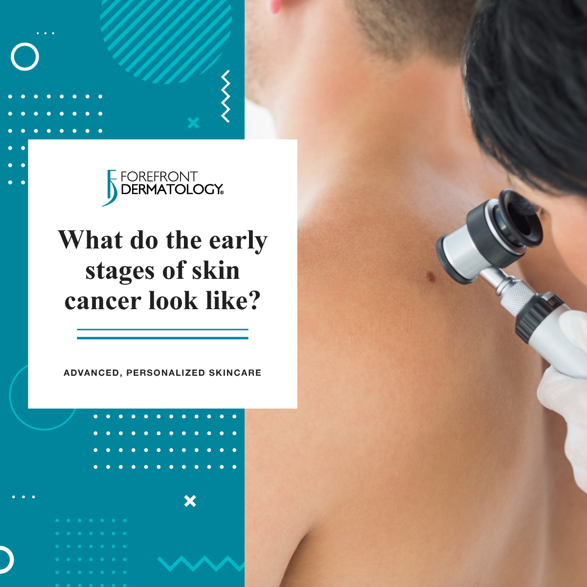 What Do The Early Stages of Skin Cancer Look Like? | Forefront Dermatology