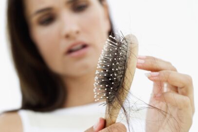 Hair Loss in Women
