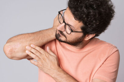 What Causes Eczema Flareups?
