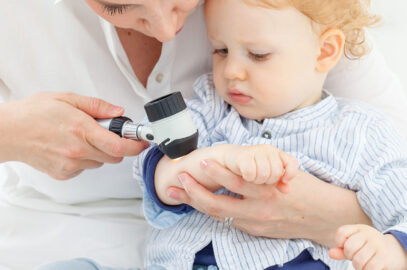 Eczema in Toddlers