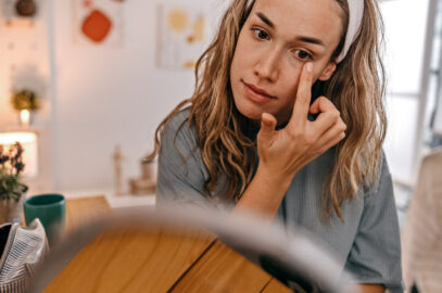 Preventing Dark Circles Around Eyes