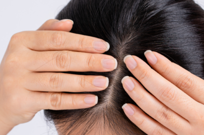 At-Home Dry Scalp Treatment