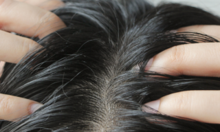 3 Ways to Tighten Skin without Surgery (or Needles)